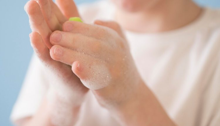 پاک کردن چسب از روی دست